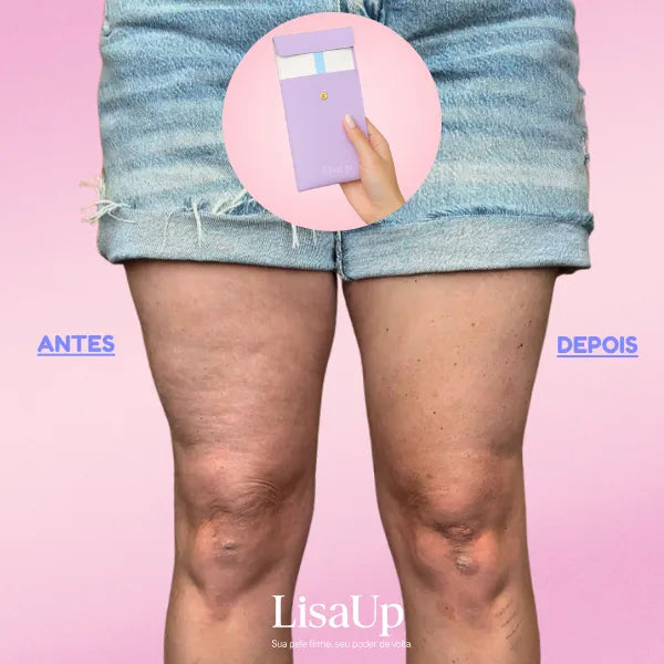 LisaUP™