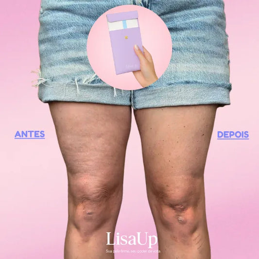 LisaUP™